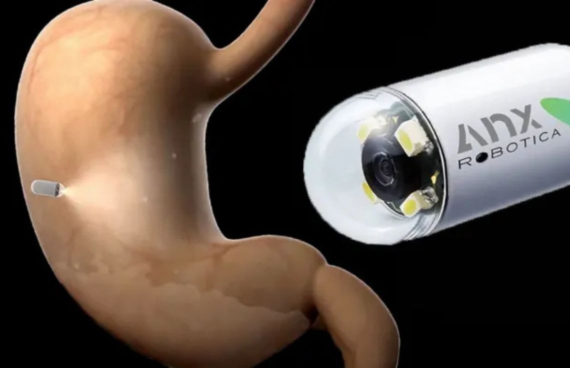 ބަނޑާއި ގޮހޮރުގެ ބަލިތައް ދެނެގަނެވޭ ކެޕްސޫލަކާއި ހިތުގެ ބަލި ދެނެގަންނަ އެޕެއް އޭއައި ބޭނުންކޮށްގެން ތަރައްޤީކޮށްފި!