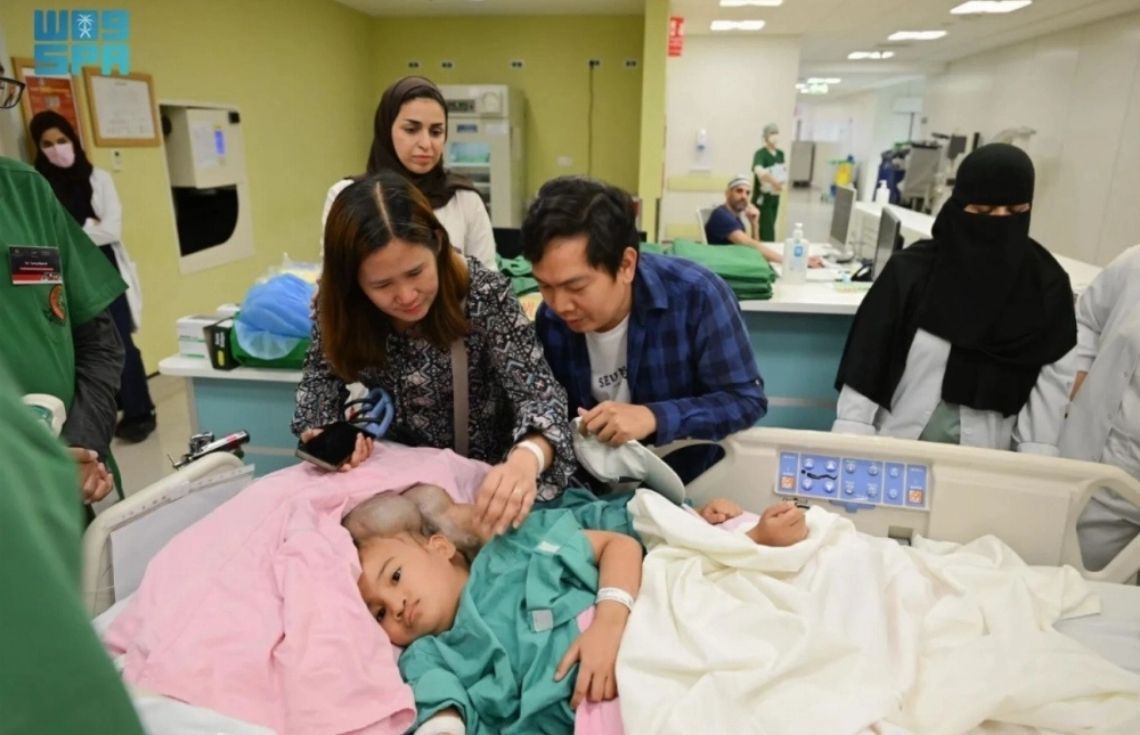 ދުނިޔޭގެ އެންމެ އުނދަގޫ އެއް އޮޕަރޭޝަން: ފިލިޕީންސްގެ ބޮލުން ގުޅިފައިވާ ދެބެން ވަކިކުރުމުގެ މަސައްކަތް ސައުދީން ފަށައިފި