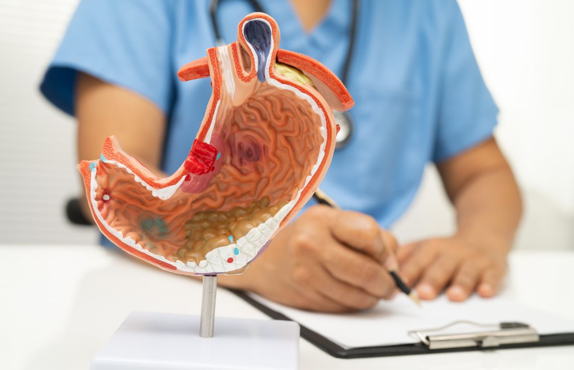 ގޭސްޓްރިކް އަލްސަރ: ސަބަބުތަކާއި، ފަރުވާ އަދި ރައްކާތެރިކަން