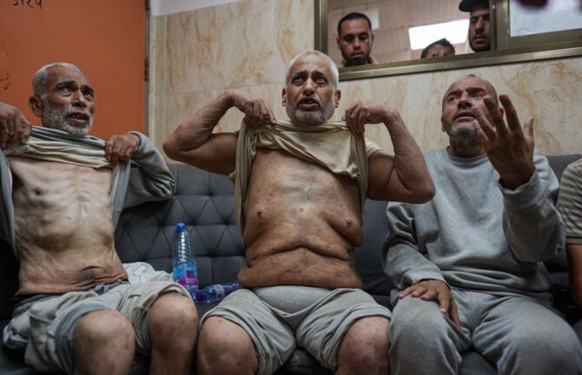 އިސްރާއިލުން ހައްޔަރުކޮށްގެން ގެންގުޅު ޣައްޒާގެ 15 މީހަކު ދޫކޮށްލައިފި، ހަށިގަނޑުގައި އަނިޔާގެ ނިޝާންތައް ވަރަށް ގިނަ